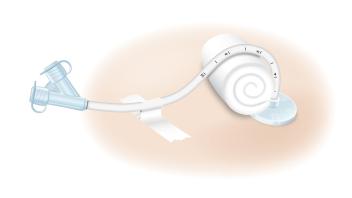 Medical Illustration