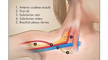 Medical Illustration